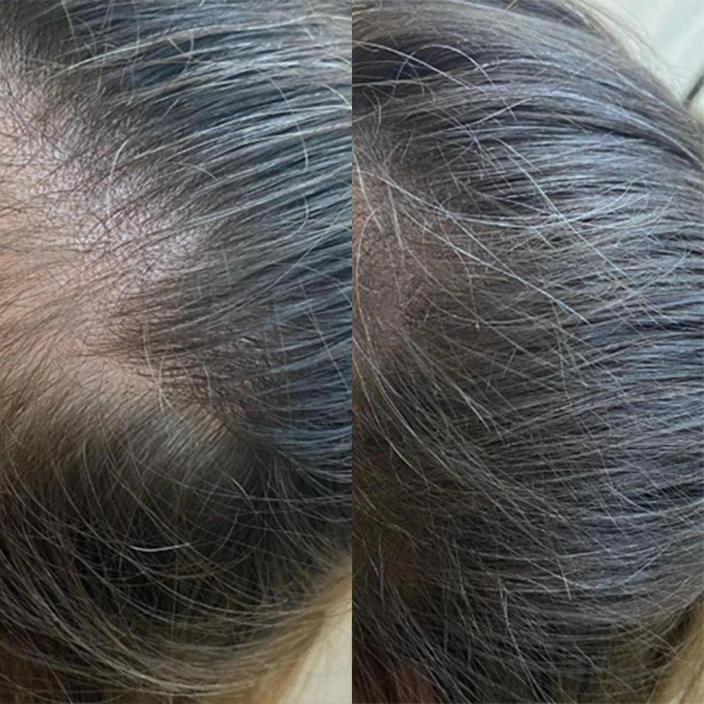 Panthrix - Haarwuchs Aktivator - dreamhair Shop